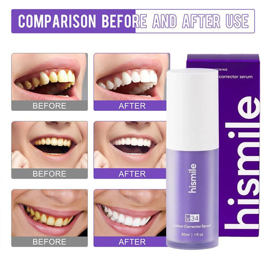 Hismile V34 Colour Corrector Serum – Instant Teeth Brightening (Purple Formula)